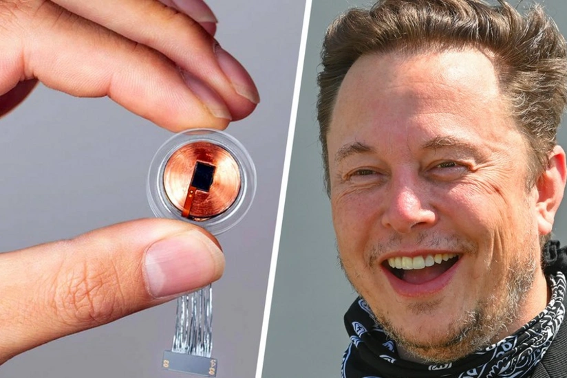 Elon Musk's Neuralink implants brain chip in first human