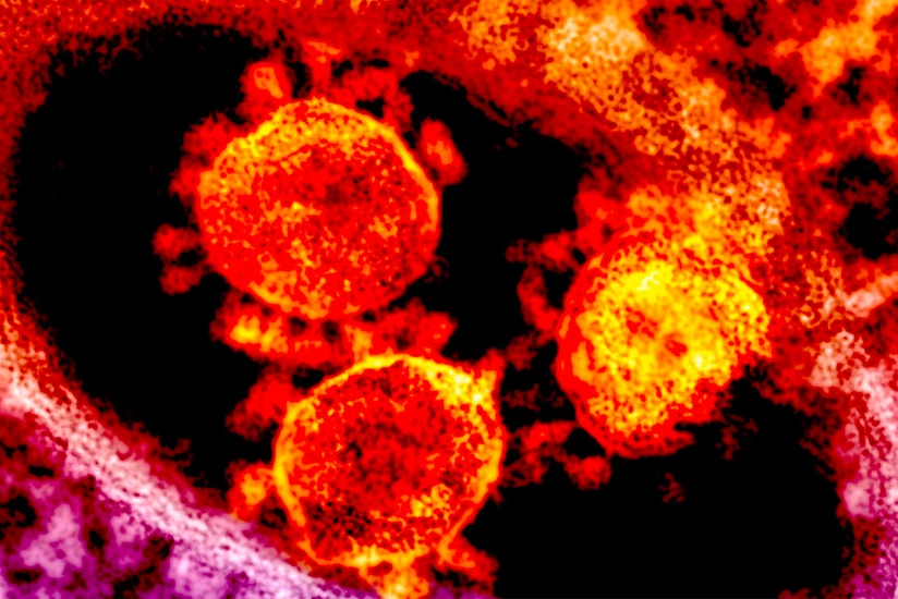 Finland discovers new COVID-19 strain