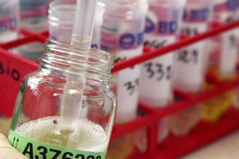 WADA: Dopinq-testlərdən 1,36 faizinin nəticəsi müsbət olub