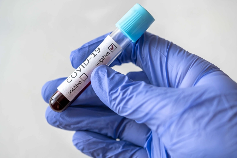 Azerbaijan confirms 1,307 new COVID-19 cases, 27 deaths
