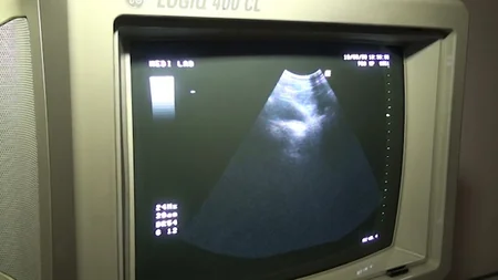 Ağdamın Quzanlı qəsəbəsində ödənişsiz səyyar tibbi xidmət aksiyası keçirilib