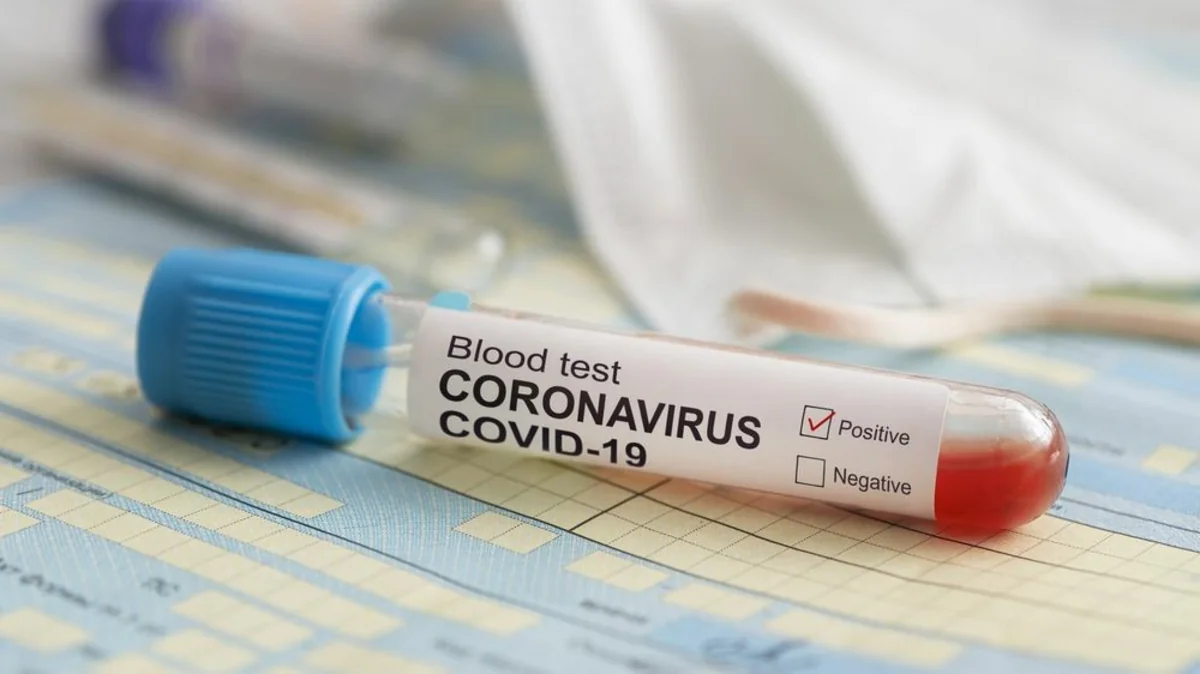 Coronavirus: Village in Azerbaijan’s occupied Karabakh isolated