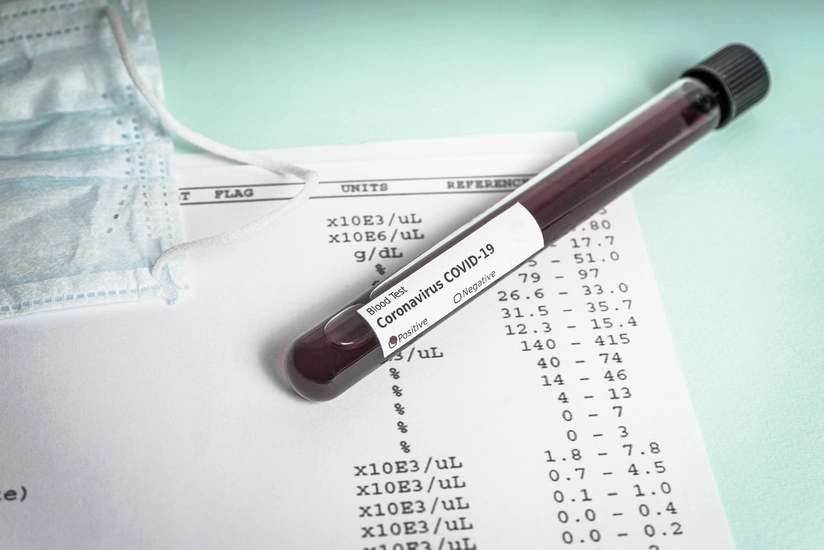 İndoneziyada koronavirus testinin cavabı 3 dəqiqəyə hazır olacaq
