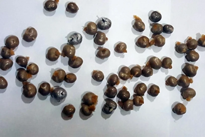 Azərbaycan vətəndaşının mədəsindən 131 qram heroin çıxıb