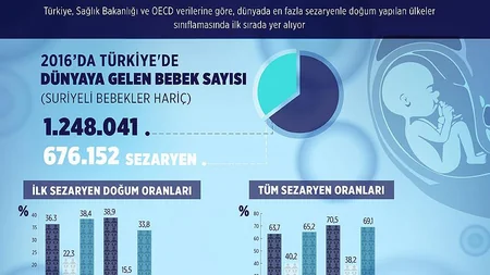 Türkiyə qeysəriyyə əməliyyatının ən çox aparıldığı ölkədir