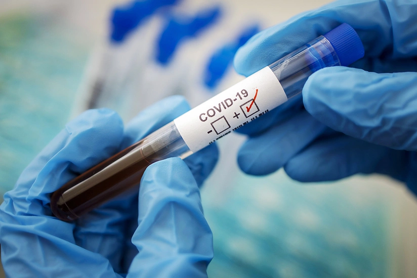 What causes false-positive COVID-19 results