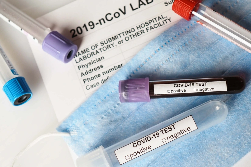 Gürcüstanda COVID-19-a yoluxma halları artıb