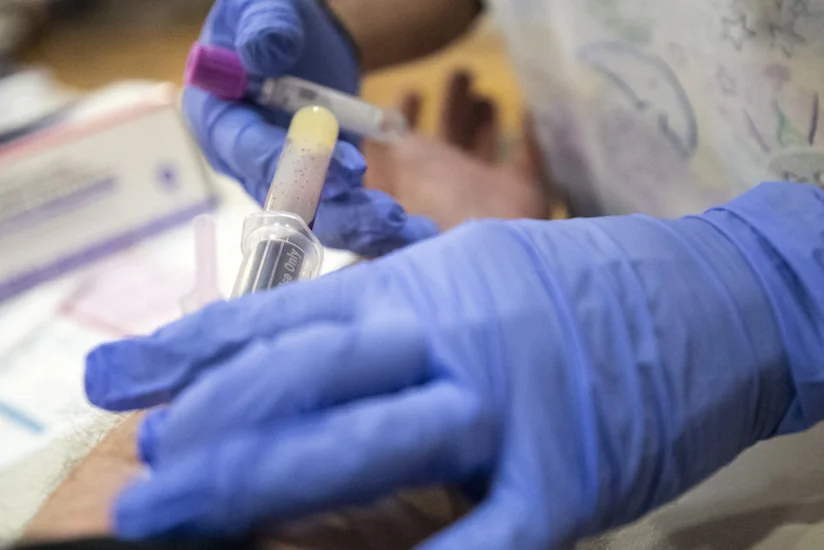 Dünyada koronavirusa yoluxma sayında azalma müşahidə olunur