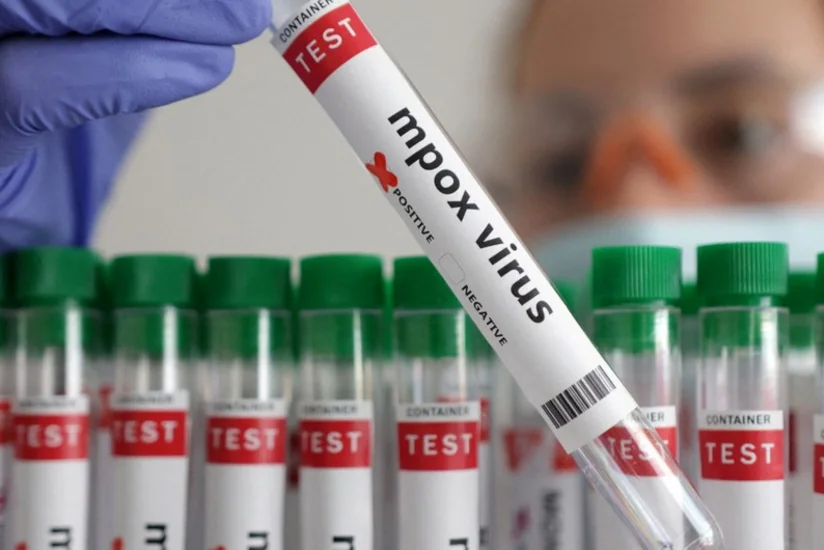 Число заболевших mpox с начала года в Африке превысило 50 тысяч