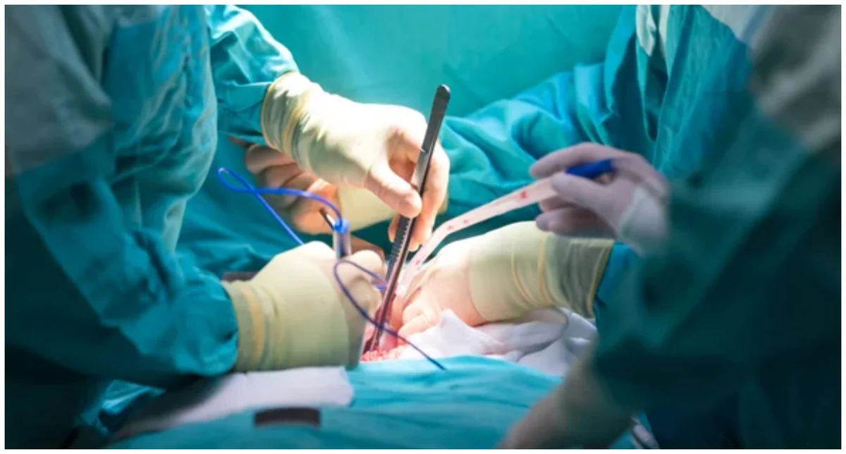 Böyrəyin transplantasiyası metodu ilə müalicə zərurətinin təcililik statusuna dair meyarlar müəyyənləşib
