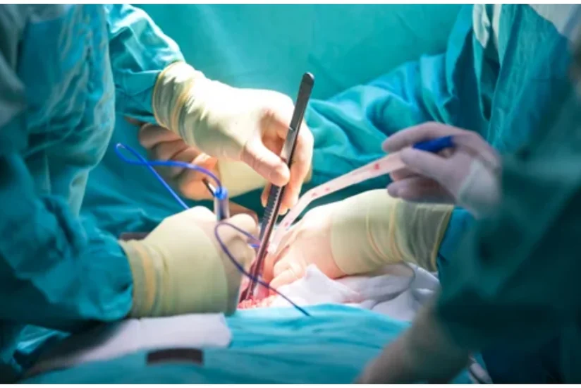 Böyrəyin transplantasiyası metodu ilə müalicə zərurətinin təcililik statusuna dair meyarlar müəyyənləşib