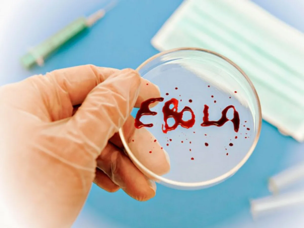 ​ÜST: Ebola virusunun yayılması böyük təhlükədir