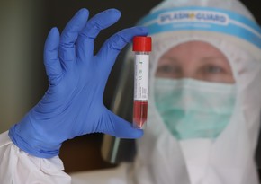 Azerbaijan confirms 47 new COVID-19 cases, 2 died