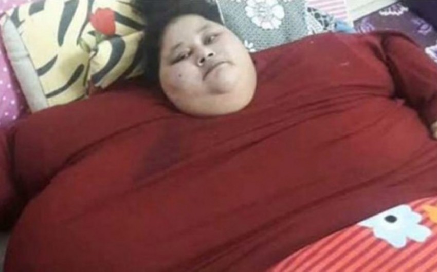 Dünyanın ən kök qadını 5 həftəyə 140 kq. arıqlayıb