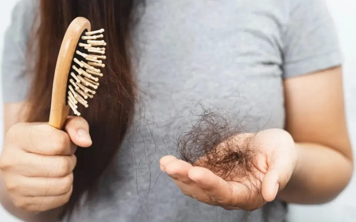 Dermatoloq: Saçların tökülməsi əksər hallarda streslə əlaqədardır
