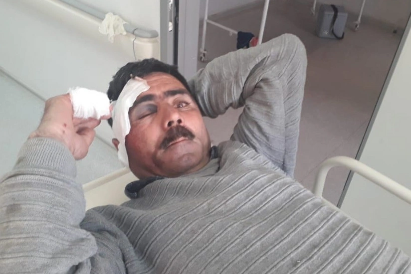 Ucarda usta yıxılaraq xəsarət aldı - FOTO