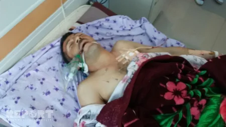​Состояние двух граждан Азербайджана, раненых в результате артиллерийских ударов армян по Агдамскому району, остается тяжелым - ФОТО - ВИДЕО
