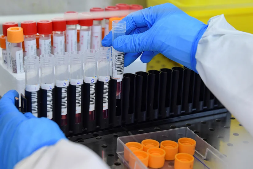 İtaliyada koronavirusun “Omikron-2” ştamı aşkarlanıb