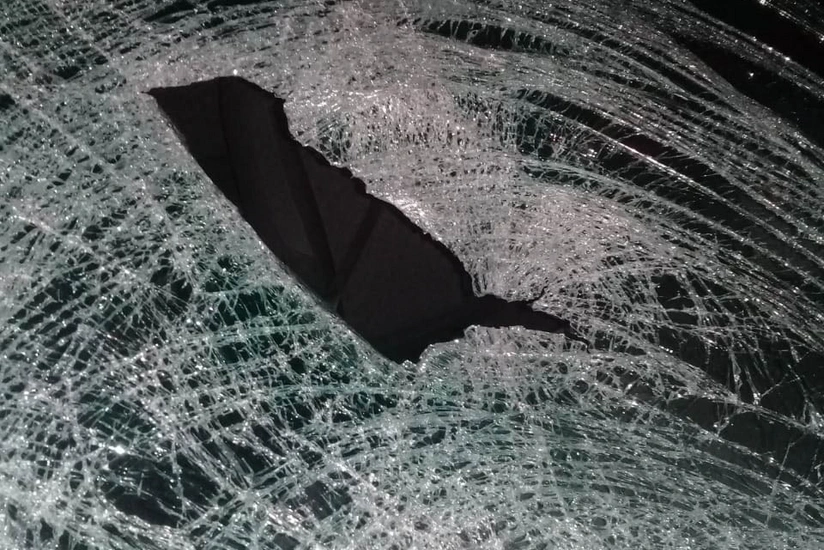 Bakıda avtomobil gənc qızı vuraraq xəsarət yetirib