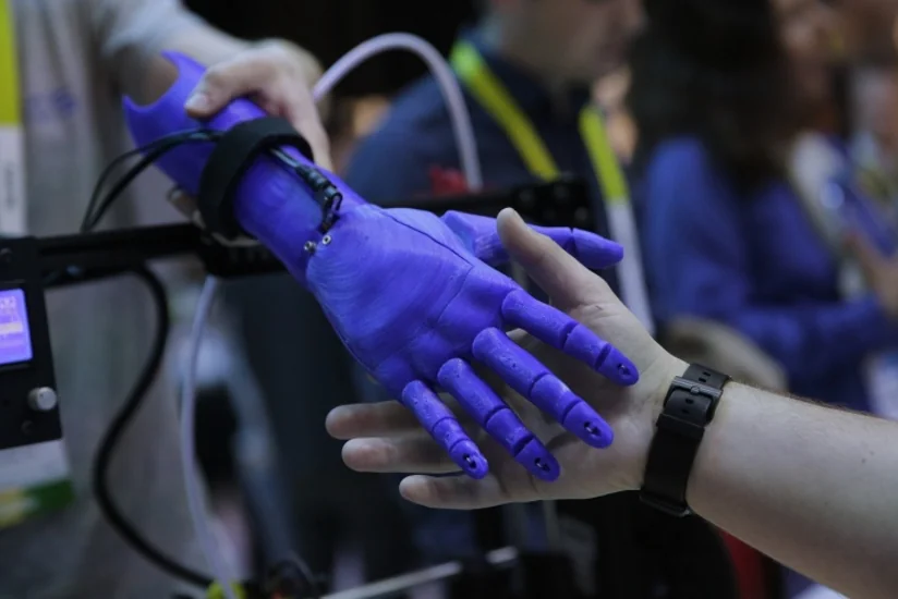​Fransada əlil uşağın 3D printer texnologiyası ilə əl protezi çap edilib