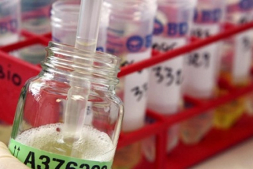 ​More than 6,000 doping tests are scheduled to take at Rio Olympics 2016