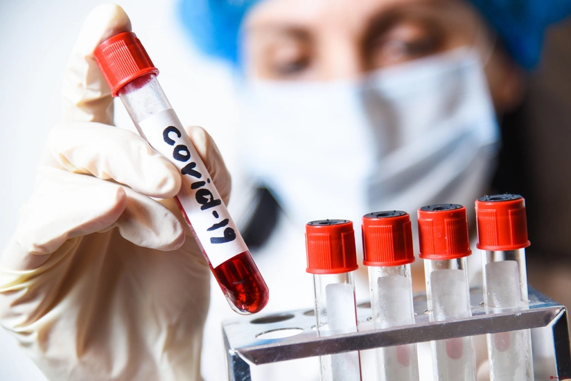 Deputat: Koronavirus testinin qiymətinə yenidən baxılmalıdır