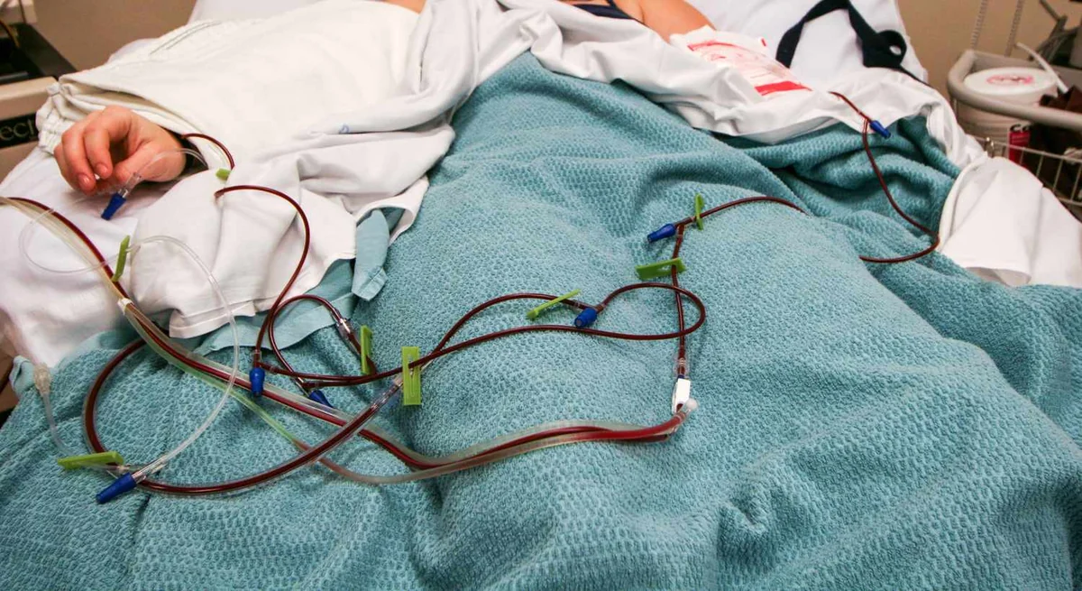 Sümük iliyi transplantasiyası cərrahi müdaxilə olmadan həyata keçiriləcək