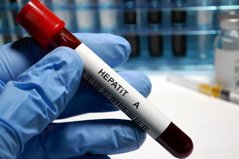 Nazirlik: Azərbaycanda hepatit A virusuna yoluxma halları azalıb, vəziyyət nəzarətdədir