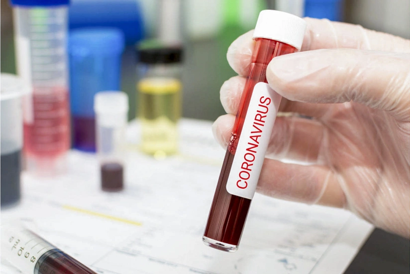 Georgia confirms 5,240 more COVID-19 cases, 68 deaths