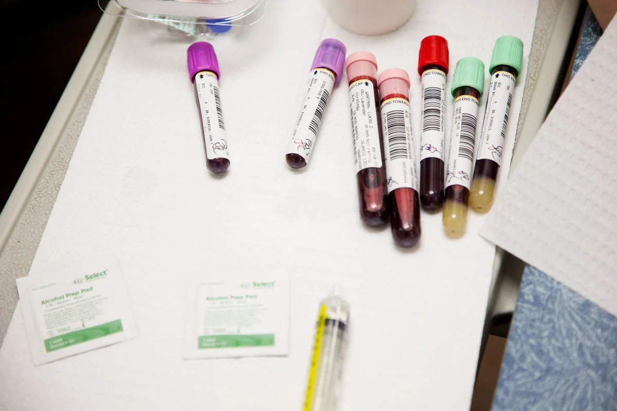 Gürcüstanda ilin əvvəlindən 99 nəfər QİÇS-dən ölüb