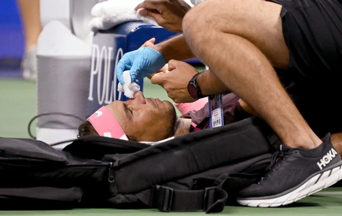 Rafael Nadal burnunu sındırıb