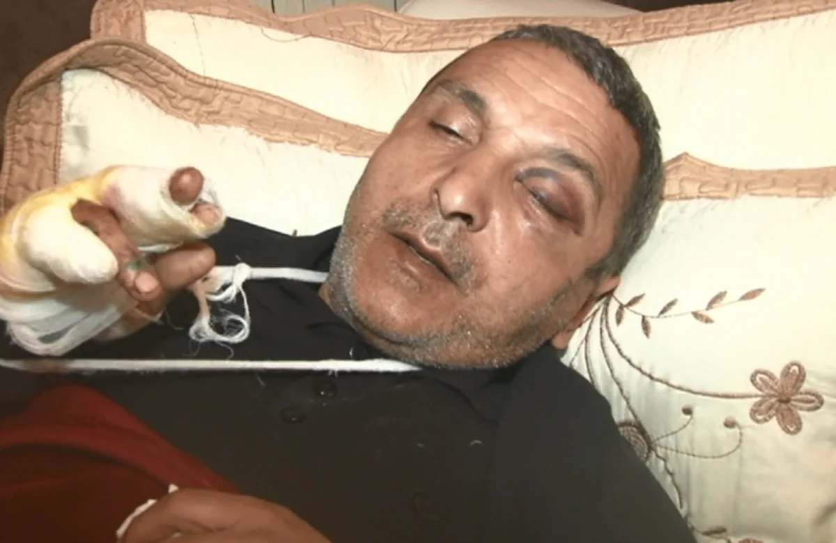 Taksi sürücüsü bıçaqlanıb - FOTO