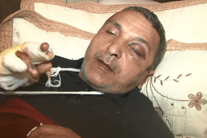 Taksi sürücüsü bıçaqlanıb - FOTO