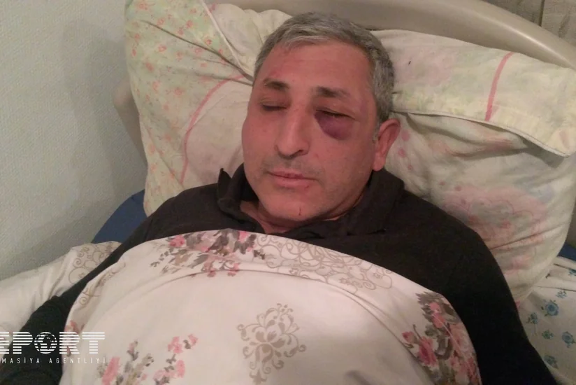 Cəlilabad sakini borca görə döyülüb - FOTO