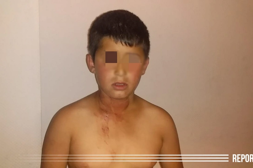 В Баку отец ранил ножом отказавшегося попрошайничать сына - ФОТО