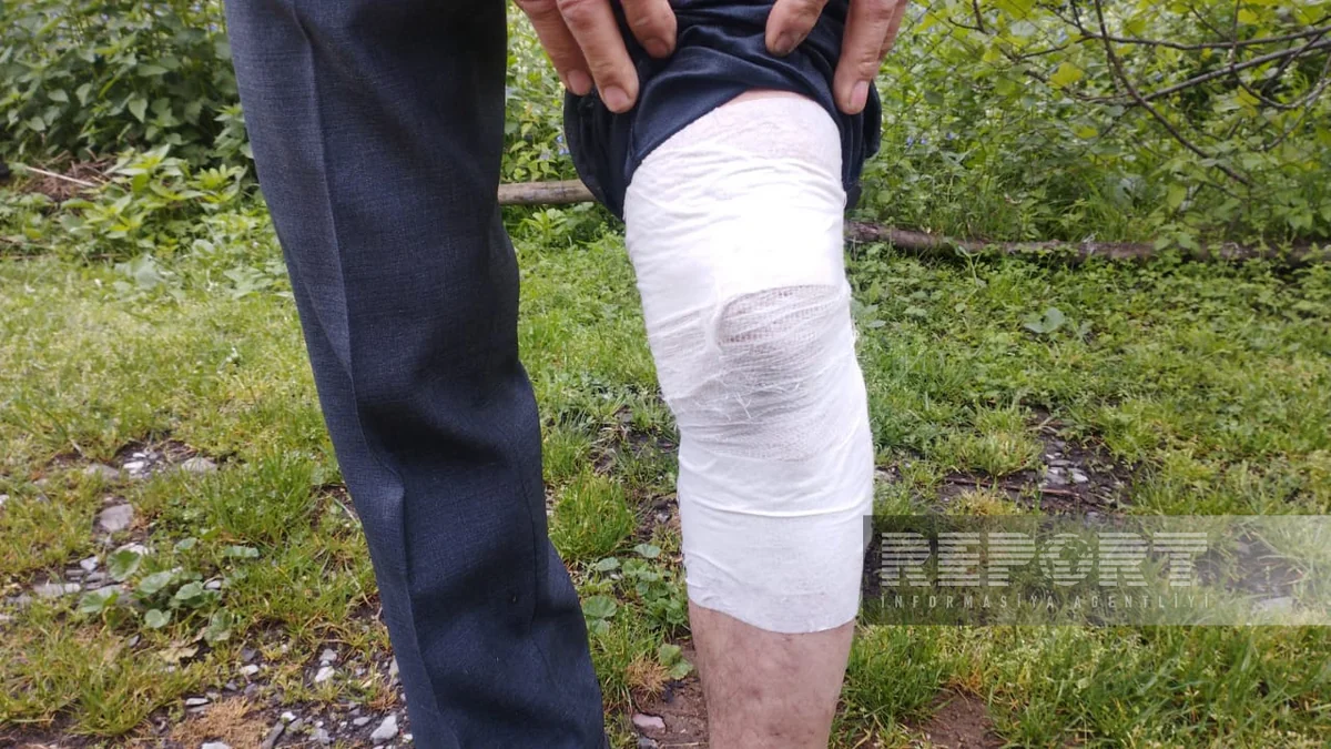 Oğuzda çaqqal 56 yaşlı kişiyə hücum edib