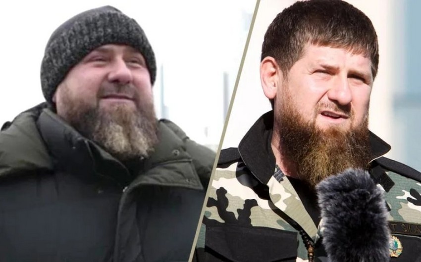 СМИ: у Кадырова серьезные проблемы со здоровьем