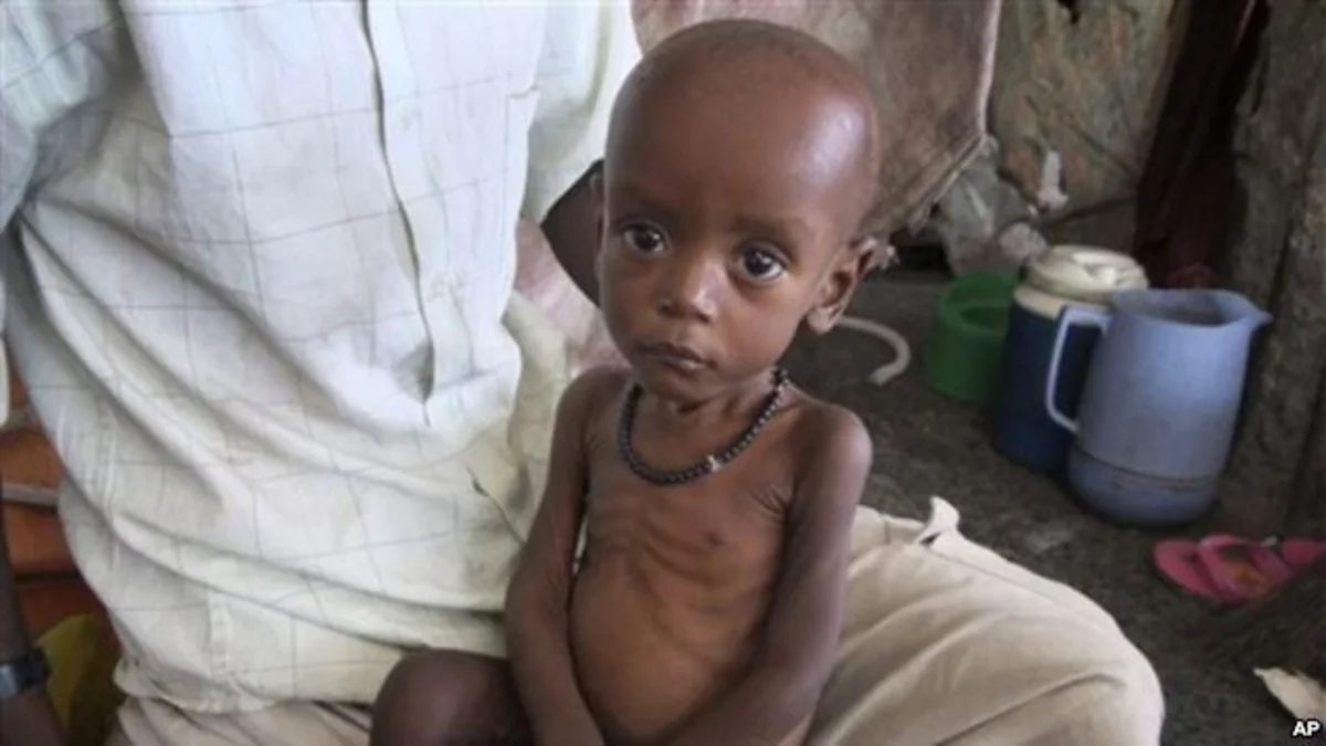 İnkişaf etməkdə olan ölkələrdə uşaq ölümü halları azalmaqdadır