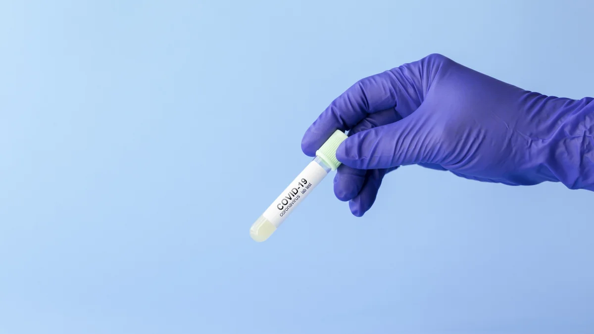 Azerbaijan reports 4 new COVID-19 cases