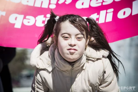 Bu gün Beynəlxalq Daun Sindromu Günüdür - FOTOREPORTAJ