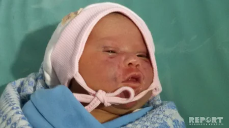 Bərdə xəstəxanasının qarşısına atılan körpənin evdə doğulduğu məlum olub - FOTO