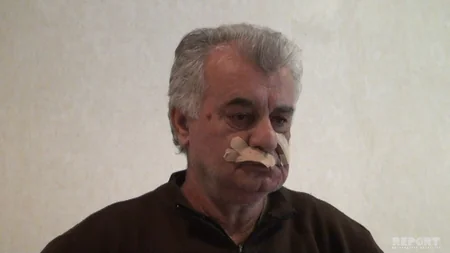 Lənkəranda yırtıcı heyvanlar sakinlərə hücum edib, 4 nəfər yaralanıb - FOTO - YENİLƏNİB