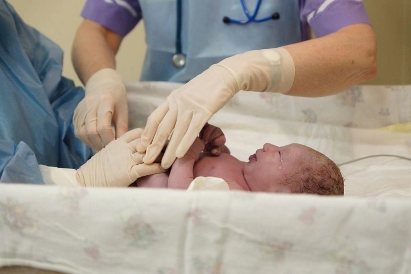 Over 1,000 twins born in Azerbaijan in 1H25