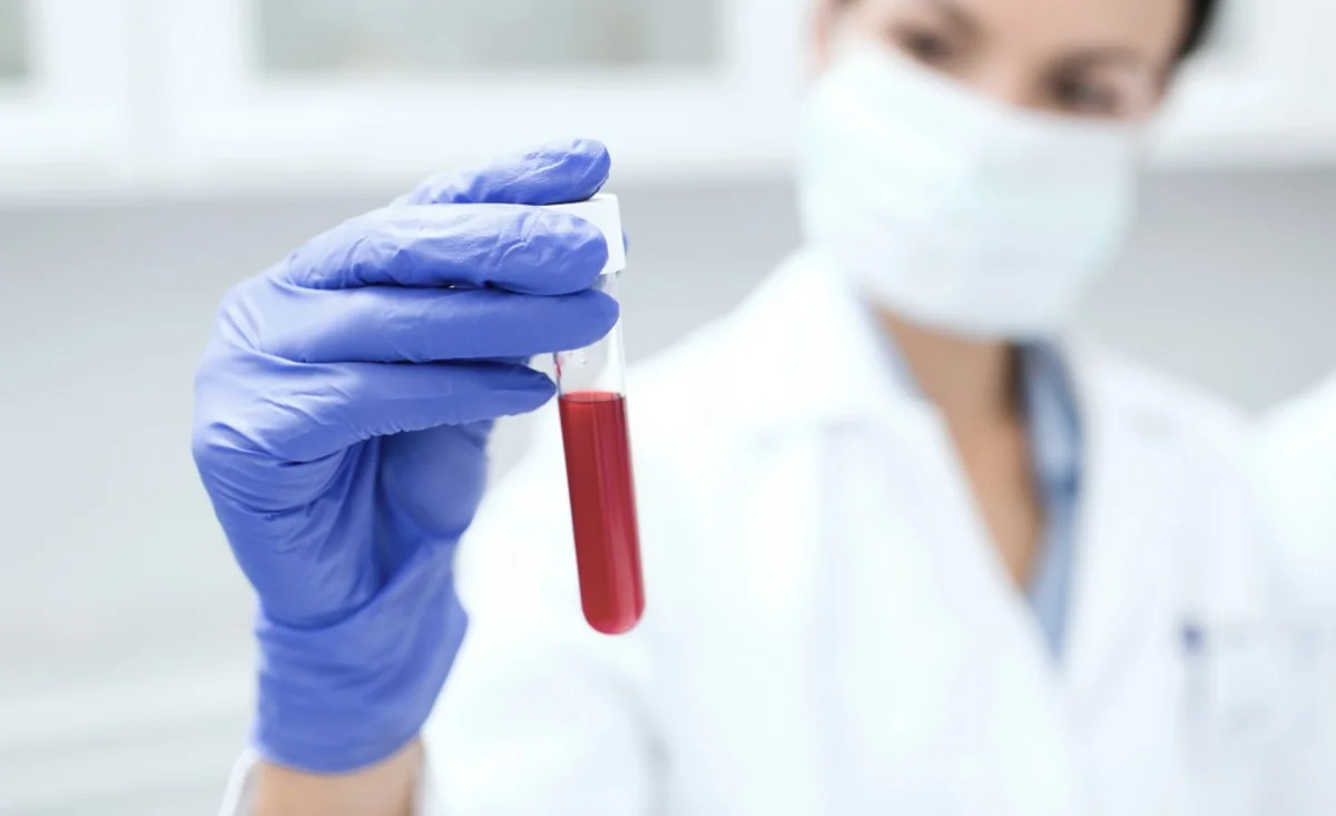 Azərbaycanda koronavirusla bağlı testlərin sayı açıqlandı - RƏSMİ