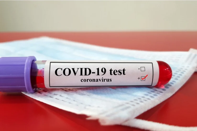 В Азербайджане за сутки COVID-19 заразились 136 человек