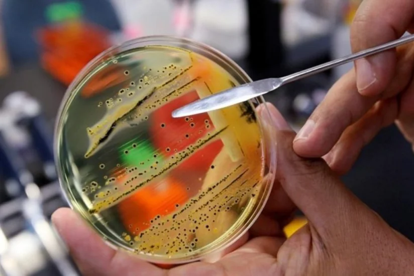 В Канаде в результате вспышки сальмонеллеза заболели около 50 человек