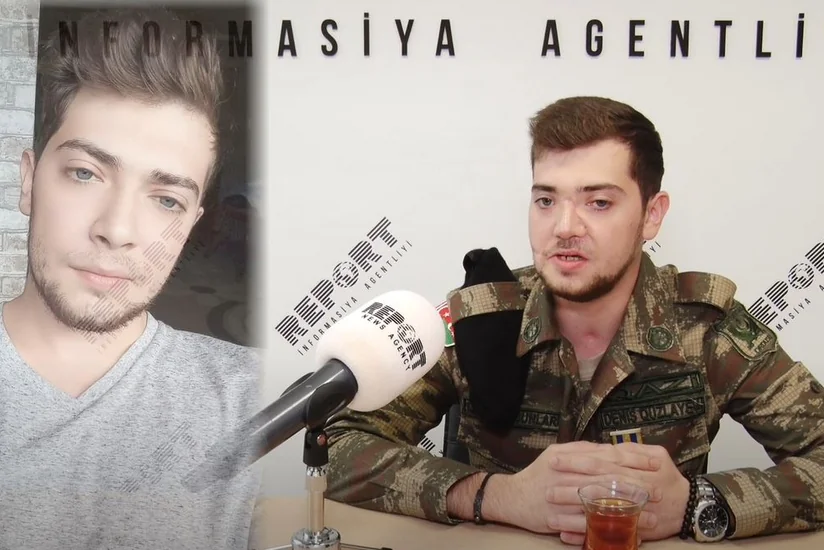 Ветеран Отечественной войны: Война - это шрамы на моем лице