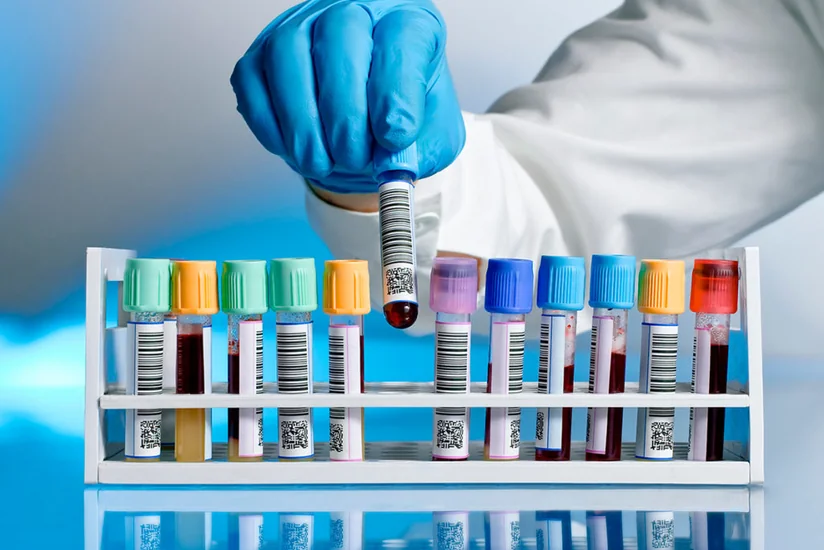 COVID-19 analiz nəticəsini onlayn qaydada əldə etmək mümkün olacaq