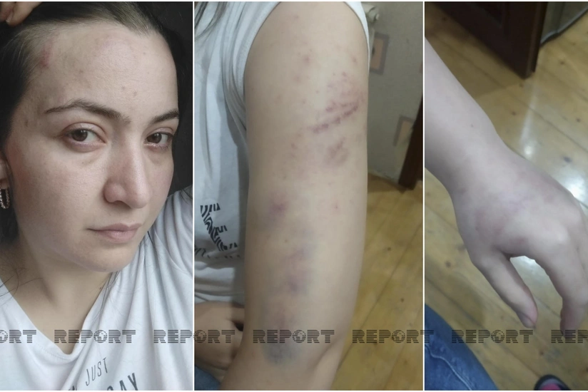 Arvadını güllələyərək öldürən polis bir gün əvvəl onu dəyənəklə döyübmüş