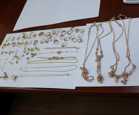 Türkiyədən Azərbaycana gələn qadının daxili orqanından 114 ədəd qızıl-zinət əşyası aşkarlanaraq götürülüb